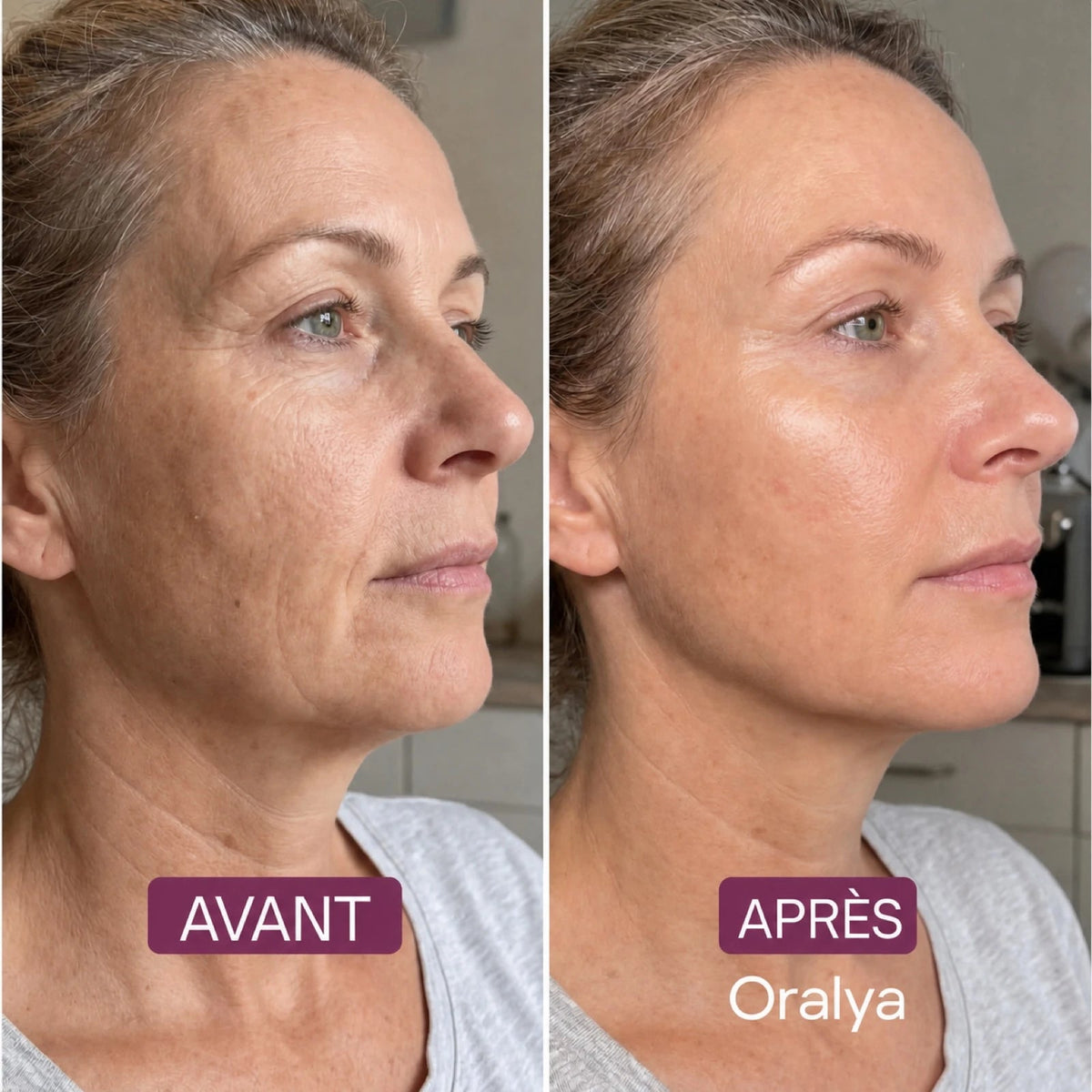 Masque Enveloppant au Collagène - Oralya
