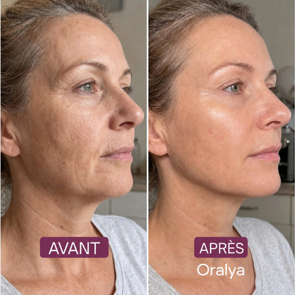 Masque Enveloppant au Collagène - Oralya