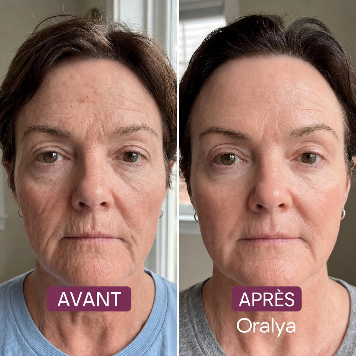 Masque Enveloppant au Collagène - Oralya